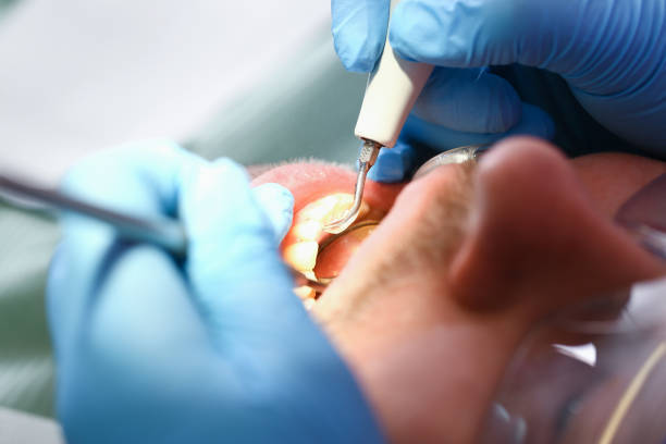 Best Broken or Cracked Tooth Emergency Dentist in Dallas, NC